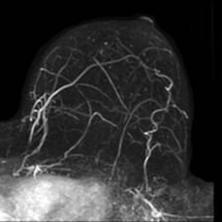 Brust